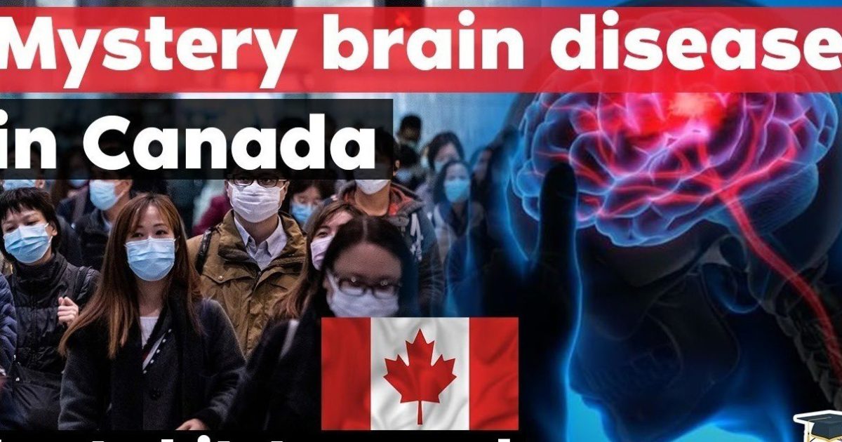 Mystérieuse épidémie cérébrale au Canada
