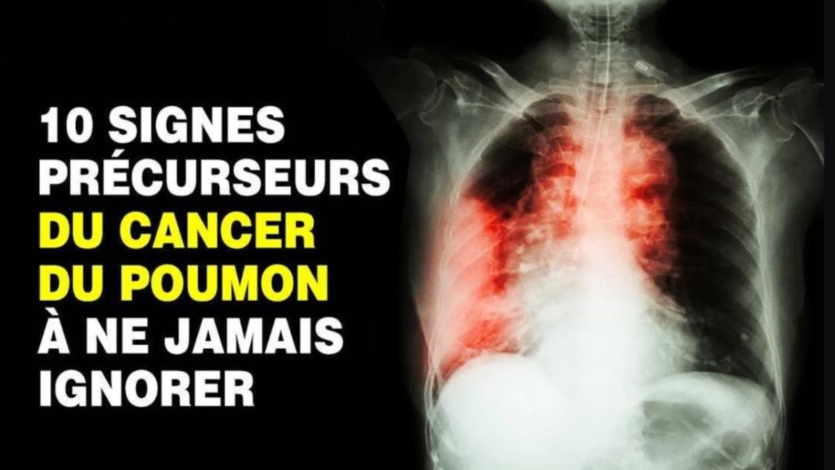 Le cancer des poumons est un tueur silencieux