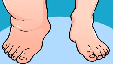 Pieds et chevilles gonflés