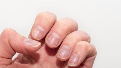 3 Solutions Naturelles pour Fortifier Vos Ongles Fragiles