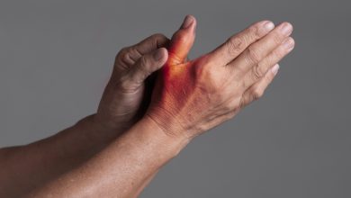 Arthrose