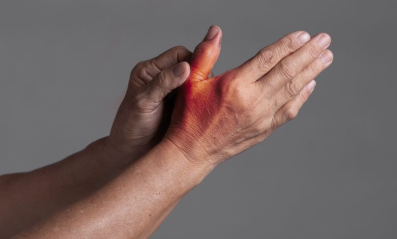 Arthrose