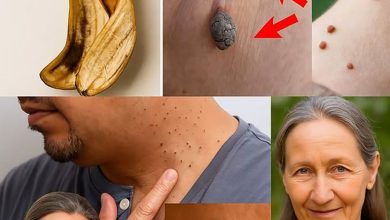 Dites adieu aux acrochordons du visage grâce à la peau de banane