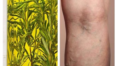 Romarin Varices