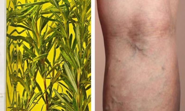 Romarin Varices