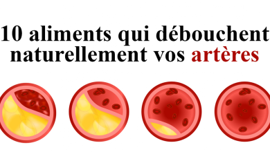 Déboucher Les Artères Et Prévenir Les Crises Cardiaques