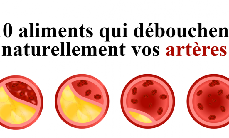 Déboucher Les Artères Et Prévenir Les Crises Cardiaques