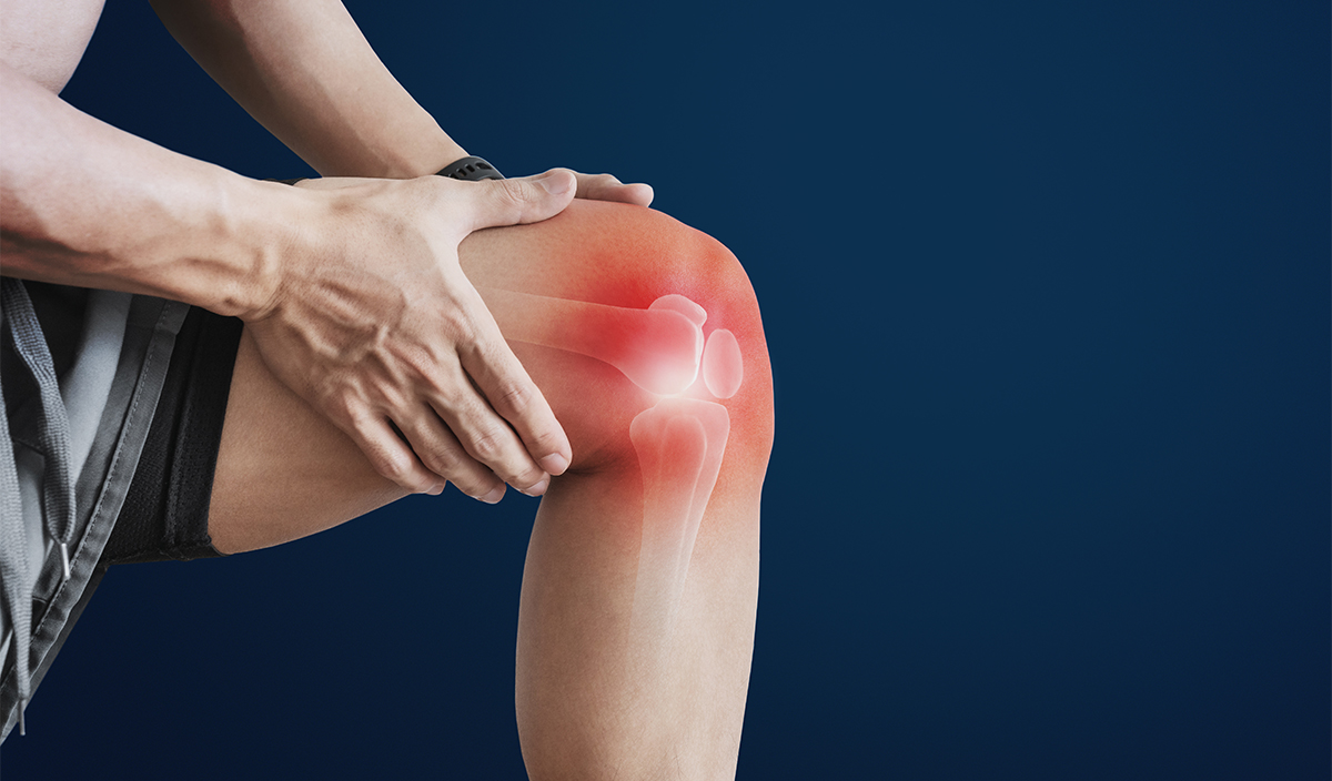 arthrose du genou