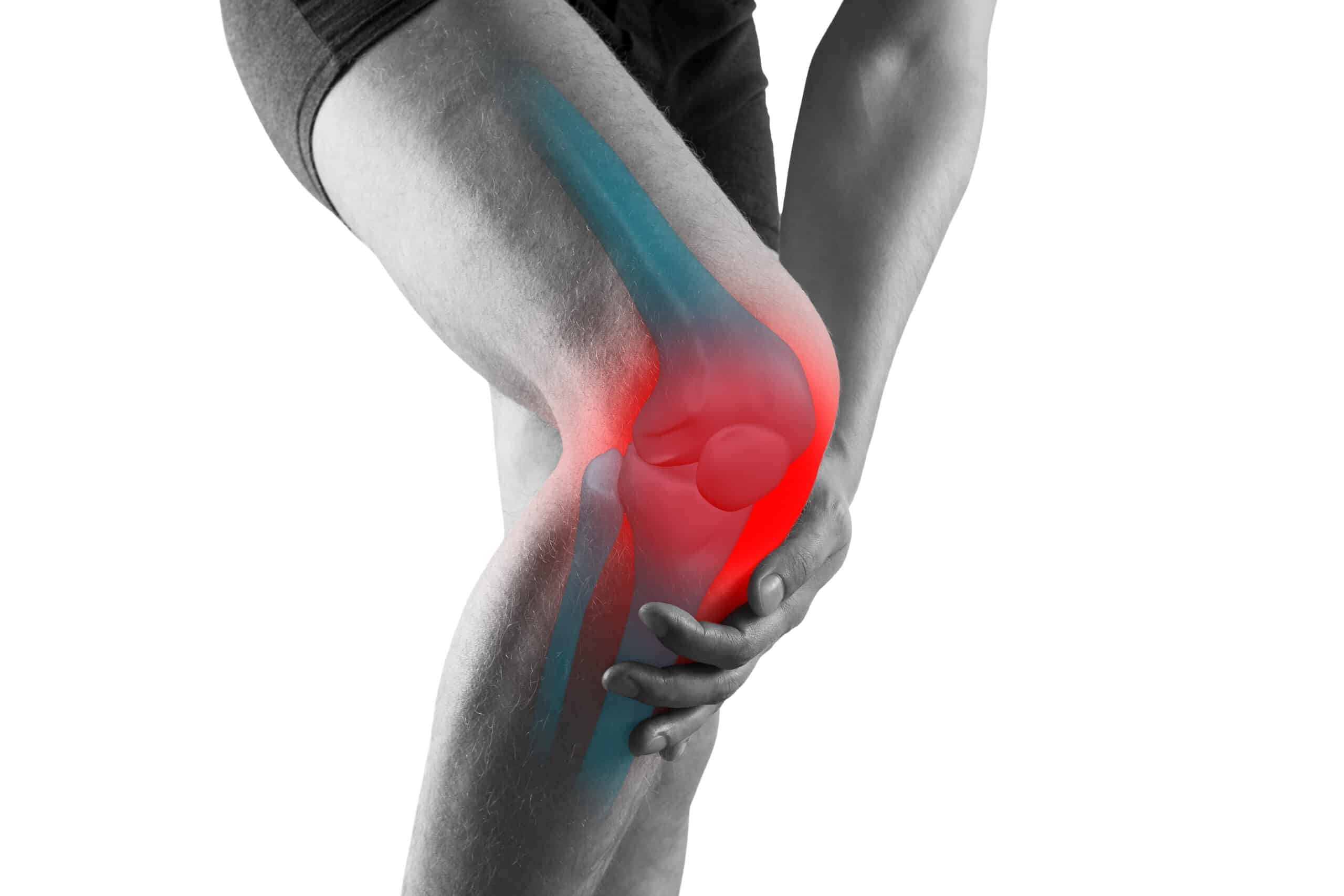 arthrose du genou