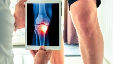 arthrose du genou