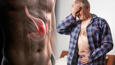 Cancer de l'estomac